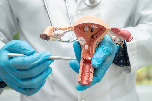 Doctorul ține un model anatomic al uterului pentru a studia endometrioza