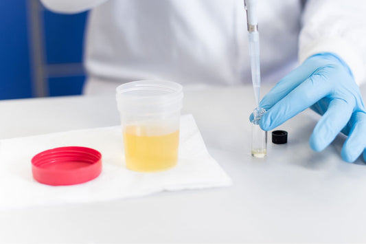 Un medic care testează o mostră de urină